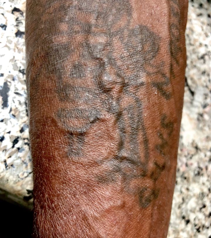 Alternatives Hiding Varicose Veins with Tattoos