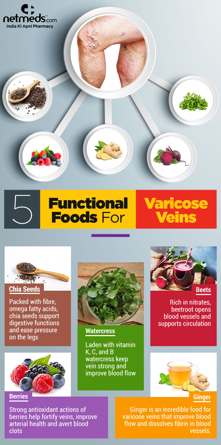 Role Diet Varicose Veins