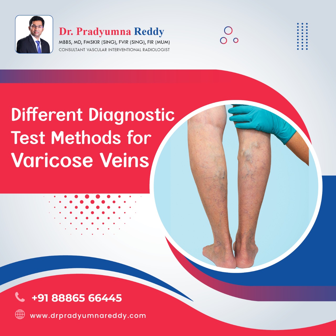 Diagnosis Methods Varicose Veins