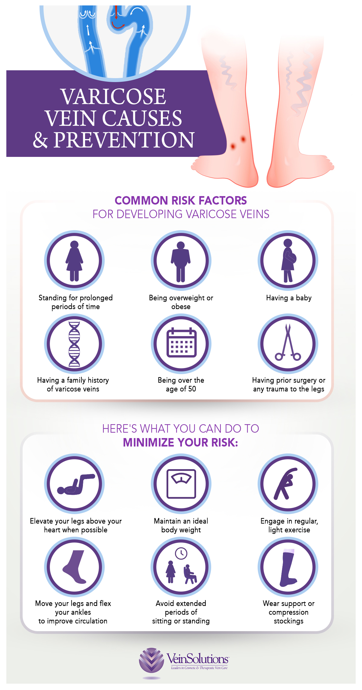 Risk Factors Varicose Veins