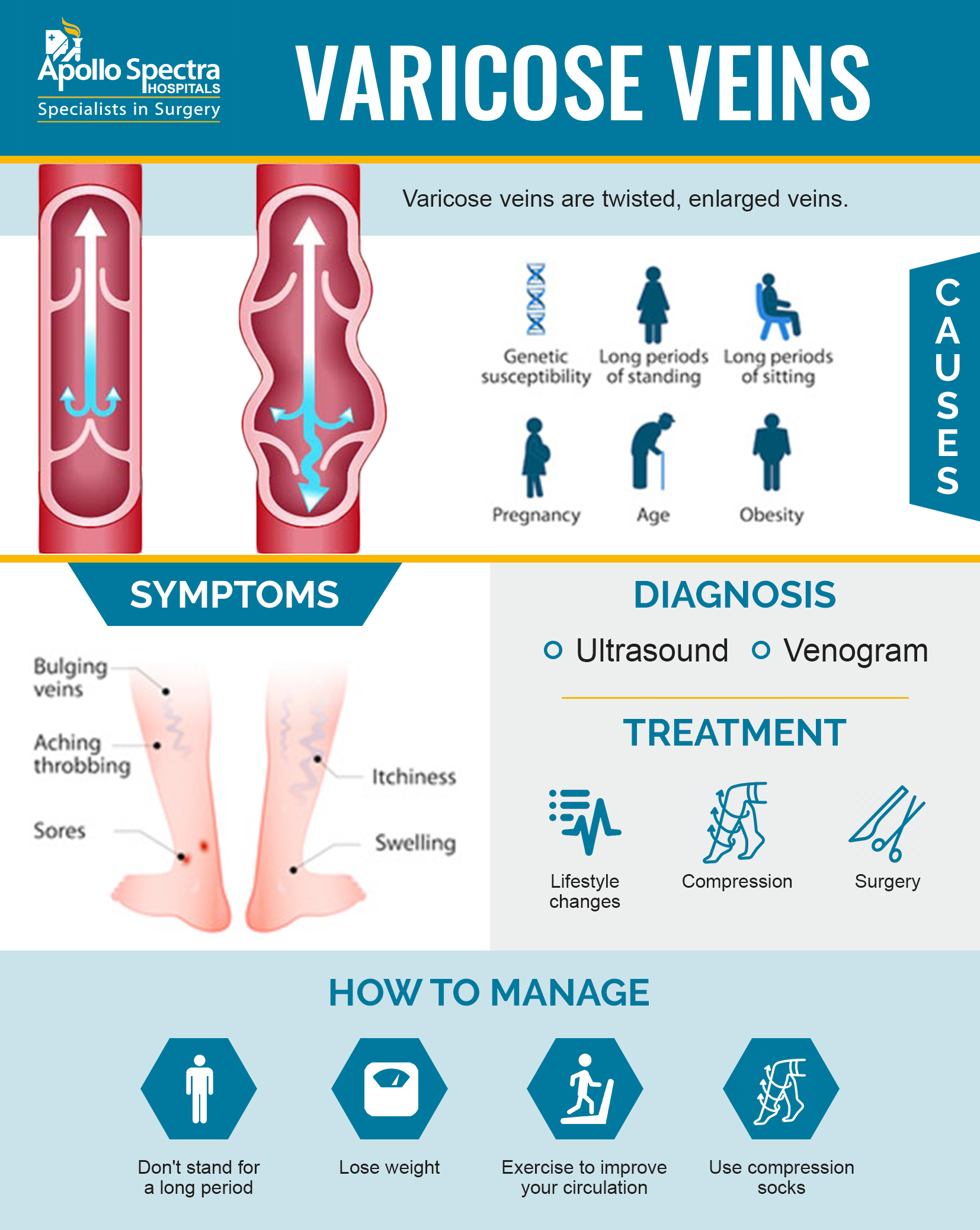 Treatment Options Varicose Veins